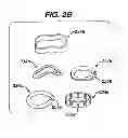 Fig. 04 - Polyaxial bone screw