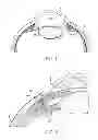 Fig. 02 - Gonio lens system with stabilization mechanism