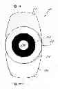 Fig. 01 - Masked intraocular implants and lenses