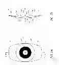 Fig. 02 - Masked intraocular implants and lenses