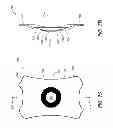 Fig. 08 - Masked intraocular implants and lenses