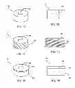 Fig. 08 - Spinal facet fusion device and method of operation