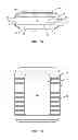 Fig. 02 - EXPANDABLE SPINAL IMPLANT AND METHODS OF USE