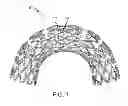 Fig. 02 - Iron Based Alloys for Bioabsorbable Stent