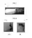 Fig. 02 - Prosthetic Attachment Techniques