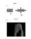 Fig. 04 - Prosthetic Attachment Techniques