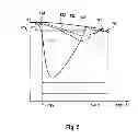 Fig. 06 - Method for Determining a Vehicle Reference Speed and Brake System