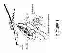 Fig. 02 - Method for early warning chatter detection and asset protection management