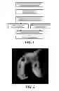Fig. 02 - Methods and Compositions for Articular Repair