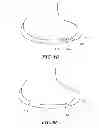 Fig. 06 - Methods and Compositions for Articular Repair