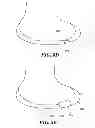 Fig. 07 - Methods and Compositions for Articular Repair