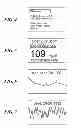 Fig. 05 - MICROPROCESSOR BASED GLUCOSE MONITORING SYSTEM