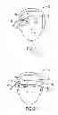 Fig. 02 - Headband for use with medical sensor