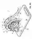 Fig. 10 - Tissue prosthesis processing technology