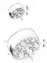 Fig. 12 - Tissue prosthesis processing technology