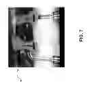 Fig. 09 - SOFT TOE POST WITH REINFORCEMENT