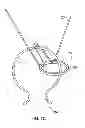 Fig. 09 - Wearable device for jewelry ring storage