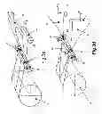 Fig. 07 - Binding apparatus and method for binding a bale