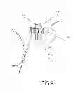 Fig. 06 - Portable gas heater