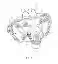 Fig. 09 - Full face respiratory mask with integrated nasal interface