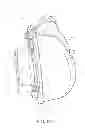 Fig. 16 - Full face respiratory mask with integrated nasal interface