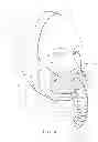 Fig. 30 - Full face respiratory mask with integrated nasal interface