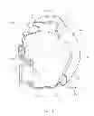 Fig. 33 - Full face respiratory mask with integrated nasal interface