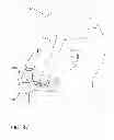 Fig. 37 - Chin pivot patient interface device