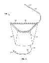 Fig. 02 - Bow Cam Cover