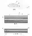 Fig. 02 - Implantable collagen devices and related methods and systems of making same