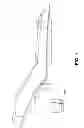 Fig. 02 - Infant child restraint system