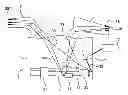 Fig. 01 - Garment incorporating a non destructive control system