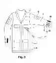 Fig. 03 - Garment incorporating a non destructive control system