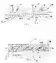 Fig. 02 - High coupling, low loss saw filter and associated method