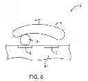 Fig. 09 - Noise-suppressing orbital relay assembly