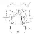 Fig. 01 - Patient identification system