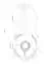 Fig. 04 - Pre-edging lens and method for manufacturing edged lens