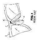 Fig. 02 - Eyeglasses with Nose Pad Assembly