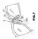 Fig. 08 - Eyeglasses with Nose Pad Assembly