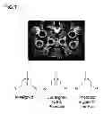 Fig. 08 - Methods and devices for refractive correction of eyes