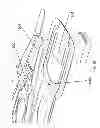 Fig. 24 - Circuit integrated suspension and method of manufacture thereof