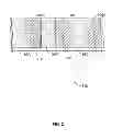 Fig. 04 - Elastic conformal transducer apparatus