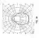 Fig. 22 - BULB CAP AND LAMP WITH APPLICATION THEREOF