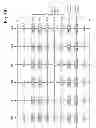 Fig. 30 - Selective word line erase in 3D non-volatile memory