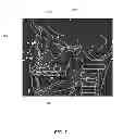 Fig. 09 - Marker identification and processing in X-ray images