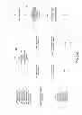 Fig. 30 - Marker identification and processing in X-ray images