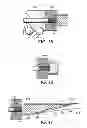 Fig. 08 - Wind or tidal turbine blade having an attachment