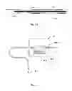 Fig. 08 - PUMP ELEMENT FOR A TUBE PUMP