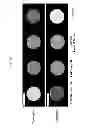 Fig. 07 - CONTRAST AGENTS
