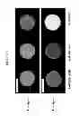 Fig. 08 - CONTRAST AGENTS